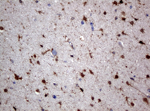 ALDH1L1 Antibody - Immunohistochemical staining of paraffin-embedded Human adult brain tissue using anti-ALDH1L1 mouse monoclonal antibody.  heat-induced epitope retrieval by 10mM citric buffer, pH6.0, 120C for 3min)