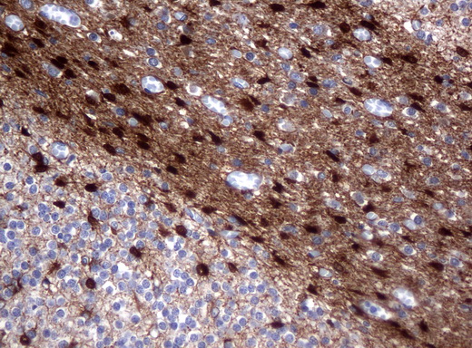 ALDH1L1 Antibody - Immunohistochemical staining of paraffin-embedded Human embryonic cerebellum using anti-ALDH1L1 mouse monoclonal antibody.  heat-induced epitope retrieval by 10mM citric buffer, pH6.0, 120C for 3min)