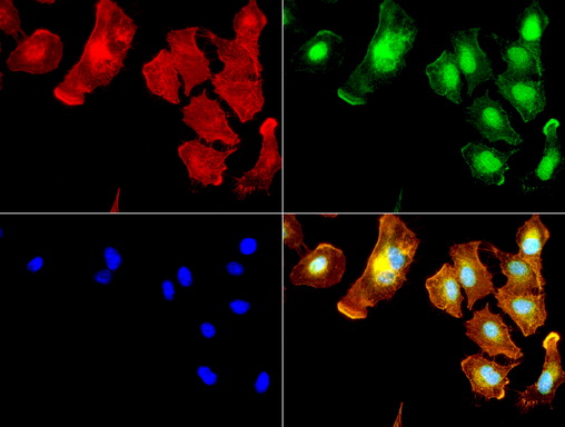 ALDH1L1 Antibody - Immunofluorescent staining of A549 cells using ALDH1L1 mouse monoclonal antibody  green). Actin filaments were labeled with TRITC-phalloidin. (red), and nuclear with DAPI. (blue). The three-color overlay image is located at the bottom-right corner.