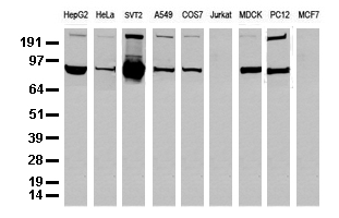 ALDH1L1 Antibody - Western blot analysis of extracts. (35ug) from 9 different cell lines by using anti-ALDH1L1 monoclonal antibody. (Clone UMAB43).