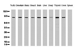 ALDH1L1 Antibody - Western Blot analysis of 10 different human tissue lysates. (10ug) by using anti-ALDH1L1 monoclonal antibody. (clone UMAB43, 1:500)
