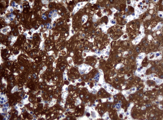 ALDH1L1 Antibody - Immunohistochemical staining of paraffin-embedded human embryonic liver tissue using ALDH1L1 clone UMAB43 mouse monoclonal antibody. Heat-induced epitope retrieval by 10mM citric buffer, pH6.0, 120C for 3min in pressure chamber/cooker.was diluted 1:400 and detection shown with HRP enzyme and DAB chromogen. Strong cytoplasmic and membranous staining is seen in the hepatocyte.