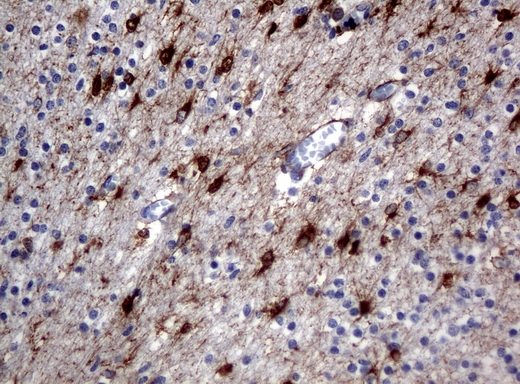 ALDH1L1 Antibody - Immunohistochemical staining of paraffin-embedded human embryonic brain cortex tissue using ALDH1L1 clone UMAB43 mouse monoclonal antibody. Heat-induced epitope retrieval by 10mM citric buffer, pH6.0, 120C for 3min in pressure chamber/cooker.was diluted 1:400 and detection shown with HRP enzyme and DAB chromogen. Strong cytoplasmic and membranous staining is seen in the in the glia, nueronal, and endothelial cells.