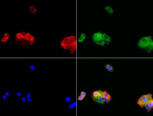 ALDH1L1 Antibody - Immunofluorescent staining of HepG2 cells using ALDH1L1 mouse monoclonal antibody  green). Actin filaments were labeled with TRITC-phalloidin. (red), and nuclear with DAPI. (blue). The three-color overlay image is located at the bottom-right corner.