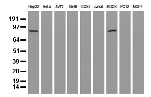 ALDH1L1 Antibody - Western blot analysis of extracts. (35ug) from 9 different cell lines by using anti-ALDH1L1 monoclonal antibody. (Clone UMAB44).