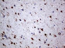 ALDH1L1 Antibody - Immunohistochemical staining of paraffin-embedded Human adult brain tissue using anti-ALDH1L1 mouse monoclonal antibody.  heat-induced epitope retrieval by 10mM citric buffer, pH6.0, 120C for 3min)