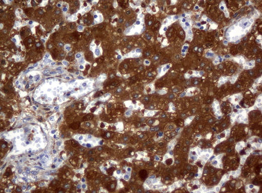 ALDH1L1 Antibody - Immunohistochemical staining of paraffin-embedded Human embryonic liver tissue using anti-ALDH1L1 mouse monoclonal antibody.  heat-induced epitope retrieval by 10mM citric buffer, pH6.0, 120C for 3min)
