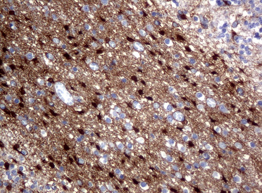 ALDH1L1 Antibody - Immunohistochemical staining of paraffin-embedded Human embryonic cerebellum using anti-ALDH1L1 mouse monoclonal antibody.  heat-induced epitope retrieval by 10mM citric buffer, pH6.0, 120C for 3min)