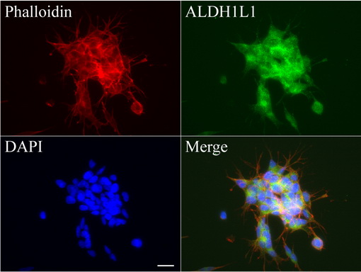 ALDH1L1 Antibody - Immunofluorescent staining of SH-SY5Y cells using anti-ALDH1L1 mouse monoclonal antibody  green, 1:100). Actin filaments were labeled with Alexa Fluor® 594 Phalloidin. (red), and nuclear with DAPI. (blue). Scale bar, 20µm.