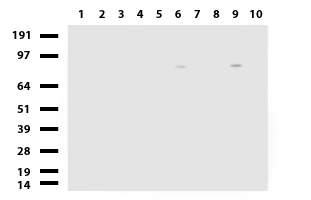 ALDH1L1 Antibody - Western blot of human tissue lysates. (15ug) from 10 different tissues. (1: Testis, 2: Omentum, 3: Uterus, 4: Breast, 5: Brain, 6: Liver, 7: Ovary, 8: Thyroid, 9: Colon, 10: Spleen). Diluation: 1:500.