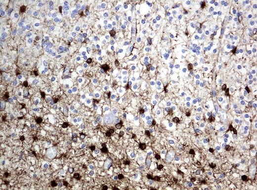 ALDH1L1 Antibody - Immunohistochemical staining of paraffin-embedded Human embryonic brain cortex tissue using anti-ALDH1L1 mouse monoclonal antibody.  heat-induced epitope retrieval by 10mM citric buffer, pH6.0, 120C for 3min)