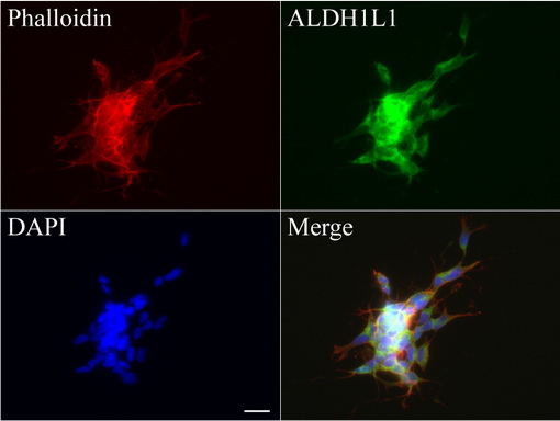 ALDH1L1 Antibody - Immunofluorescent staining of SH-SY5Y cells using anti-ALDH1L1 mouse monoclonal antibody  green, 1:100). Actin filaments were labeled with Alexa Fluor® 594 Phalloidin. (red), and nuclear with DAPI. (blue). Scale bar, 20µm.