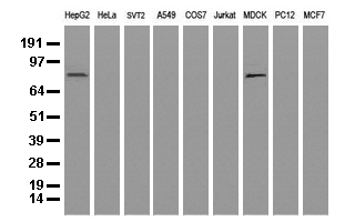 ALDH1L1 Antibody - Western blot analysis of extracts. (35ug) from 9 different cell lines by using anti-ALDH1L1 monoclonal antibody. (Clone UMAB45).
