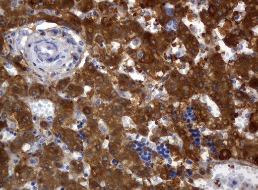 ALDH1L1 Antibody - Immunohistochemical staining of paraffin-embedded Human embryonic liver tissue using anti-ALDH1L1 mouse monoclonal antibody.  heat-induced epitope retrieval by 10mM citric buffer, pH6.0, 120C for 3min)