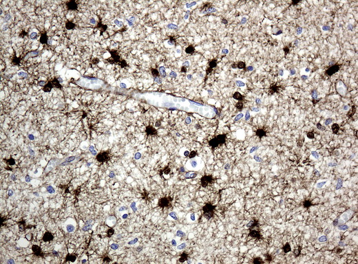 ALDH1L1 Antibody - Immunohistochemical staining of paraffin-embedded Human embryonic brain cortex tissue using anti-ALDH1L1 mouse monoclonal antibody.  heat-induced epitope retrieval by 10mM citric buffer, pH6.0, 120C for 3min)