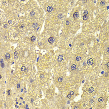 ALDH1L1 Antibody - Immunohistochemistry of paraffin-embedded Human liver injury tissue.