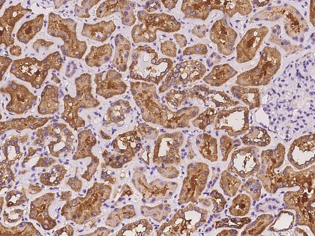 ALDH1L1 Antibody - Immunochemical staining of human ALDH1L1 in human kidney with rabbit polyclonal antibody at 1:100 dilution, formalin-fixed paraffin embedded sections.