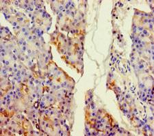 ALDH1L2 Antibody - Immunohistochemistry of paraffin-embedded human pancreatic tissue using ALDH1L2 Antibody at dilution of 1:100