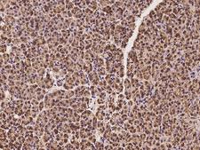ALDH1L2 Antibody - Immunochemical staining of human ALDH1L2 in human pancreas with rabbit polyclonal antibody at 1:100 dilution, formalin-fixed paraffin embedded sections.