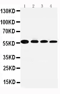 ALDH2 Antibody - WB of ALDH2 antibody. All lanes: Anti-ALDH2 at 0.5ug/ml. Lane 1: Rat Liver Tissue Lysate at 40ug. Lane 2: Rat Intestine Tissue Lysate at 40ug. Lane 3: Rat Lung Tissue Lysate at 40ug. Lane 4: Rat Kidney Tissue Lysate at 40ug. Predicted bind size: 56KD. Observed bind size: 56KD.