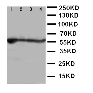 ALDH2 Antibody - Anti-ALDH2 antibody, Western blotting Lane 1: Rat Liver Tissue LysateLane 2: Rat Intestine Tissue LysateLane 3: Rat Lung Tissue LysateLane 4: Rat Kidney Tissue Lysate