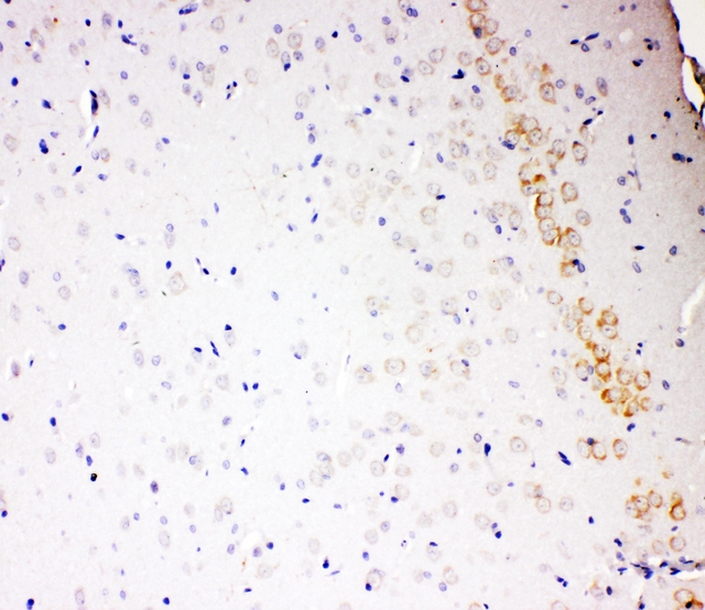 ALDH2 Antibody - IHC analysis of ALDH2 using anti-ALDH2 antibody. ALDH2 was detected in paraffin-embedded section of rat brain tissues. Heat mediated antigen retrieval was performed in citrate buffer (pH6, epitope retrieval solution) for 20 mins. The tissue section was blocked with 10% goat serum. The tissue section was then incubated with 1µg/ml rabbit anti-ALDH2 antibody overnight at 4°C. Biotinylated goat anti-rabbit IgG was used as secondary antibody and incubated for 30 minutes at 37°C. The tissue section was developed using Strepavidin-Biotin-Complex (SABC) with DAB as the chromogen.