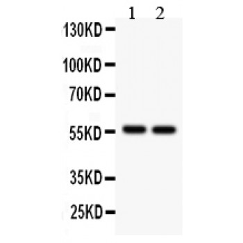 ALDH2 Antibody - ALDH2 antibody Western blot. All lanes: Anti ALDH2 at 0.5 ug/ml. Lane 1: Rat Kidney Tissue Lysate at 50 ug. Lane 2: Mouse Kidney Tissue Lysate at 50 ug. Predicted band size: 56 kD. Observed band size: 56 kD.