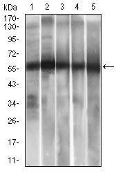 ALDH2 Antibody - Western blot using ALDH2 mouse monoclonal antibody against HepG2 (1), A549 (2) cell lysate, and Rat liver (3), Mouse liver (4), Mouse brain (5) tissue lysate.