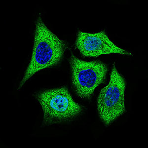ALDH2 Antibody - Immunofluorescence of HepG2 cells using ALDH2 mouse monoclonal antibody (green). Blue: DRAQ5 fluorescent DNA dye. Red: Actin filaments have been labeled with Alexa Fluor-555 phalloidin.