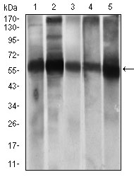 ALDH2 Antibody - Western blot using ALDH2 mouse monoclonal antibody against HepG2 (1), A549 (2) cell lysate, and Rat live (3), Mouse liver (4), Mouse brain (5) tissue lysate.