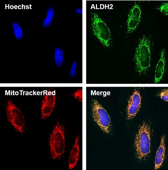 ALDH2 Antibody - ALDH2 Antibody in Immunofluorescence (IF)