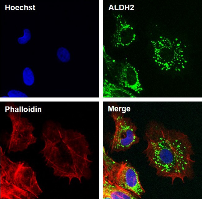 ALDH2 Antibody - ALDH2 Antibody in Immunofluorescence (IF)