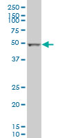 ALDH2 Antibody - ALDH2 monoclonal antibody (M01), clone 1E5 Western Blot analysis of ALDH2 expression in MCF-7.