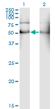 ALDH2 Antibody - Western Blot analysis of ALDH2 expression in transfected 293T cell line by ALDH2 monoclonal antibody (M01), clone 1E5.Lane 1: ALDH2 transfected lysate(56.4 KDa).Lane 2: Non-transfected lysate.