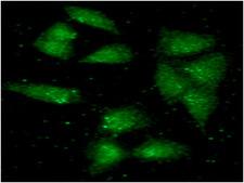 ALDH2 Antibody - ICC/IF analysis of ALDH2 in A549 cells line, stained with monoclonal anti-human ALDH2 antibody (1:100) with goat anti-mouse IgG-Alexa fluor 488 conjugate (Green).