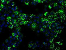 ALDH2 Antibody - Anti-ALDH2 mouse monoclonal antibody  immunofluorescent staining of COS7 cells transiently transfected by pCMV6-ENTRY ALDH2.