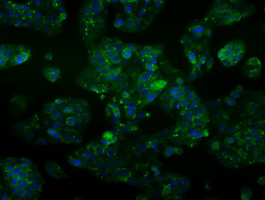 ALDH2 Antibody - Immunofluorescent staining of HepG2 cells using anti-ALDH2 mouse monoclonal antibody.