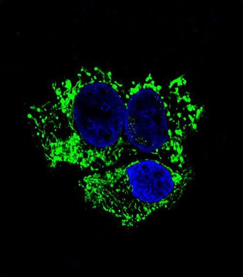 ALDH2 Antibody - Confocal immunofluorescence of ALDH2 Antibody with HepG2 cell followed by Alexa Fluor 488-conjugated goat anti-mouse lgG (green). DAPI was used to stain the cell nuclear (blue).