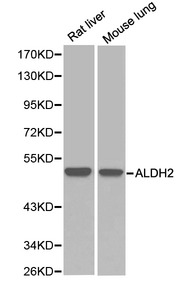 ALDH2 Antibody - Western blot of ALDH2 pAb in extracts from Rat liver and mouse lung tissue.
