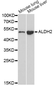 ALDH2 Antibody - Western blot analysis of extracts of various cell lines, using ALDH2 antibody at 1:1000 dilution. The secondary antibody used was an HRP Goat Anti-Rabbit IgG (H+L) at 1:10000 dilution. Lysates were loaded 25ug per lane and 3% nonfat dry milk in TBST was used for blocking.