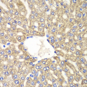 ALDH2 Antibody - Immunohistochemistry of paraffin-embedded rat liver using ALDH2 antibodyat dilution of 1:100 (40x lens).