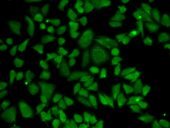 ALDH2 Antibody - Immunofluorescence analysis of HeLa cells using ALDH2 antibody.