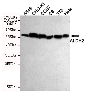ALDH2 Antibody - Western blot detection of ALDH2 in HeLa, 3T3, C6, COS7, CHO-K1 and A549 cell lysates using ALDH2 mouse monoclonal antibody (1:1000 dilution). Predicted band size: 56KDa. Observed band size:56KDa.