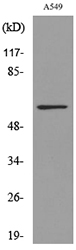 ALDH2 Antibody - Western blot analysis of lysate from A549 cells, using ALDH2 Antibody.