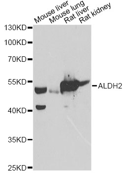 ALDH2 Antibody - Western blot analysis of extracts of various cell lines, using ALDH2 antibody at 1:1000 dilution. The secondary antibody used was an HRP Goat Anti-Rabbit IgG (H+L) at 1:10000 dilution. Lysates were loaded 25ug per lane and 3% nonfat dry milk in TBST was used for blocking. An ECL Kit was used for detection and the exposure time was 90s.