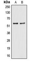 ALDH2 Antibody - Western blot analysis of ALDH2 expression in HegG2 (A); A549 (B) whole cell lysates.
