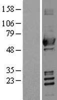 ALDH2 Protein - Western validation with an anti-DDK antibody * L: Control HEK293 lysate R: Over-expression lysate