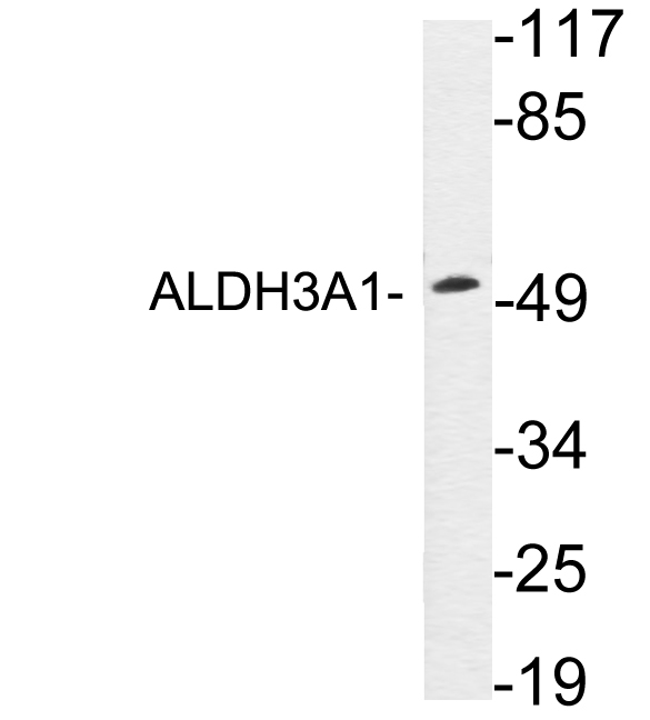 ALDH3A1 Antibody - Western blot analysis of lysates from A549 cells, using ALDH3A1 antibody.