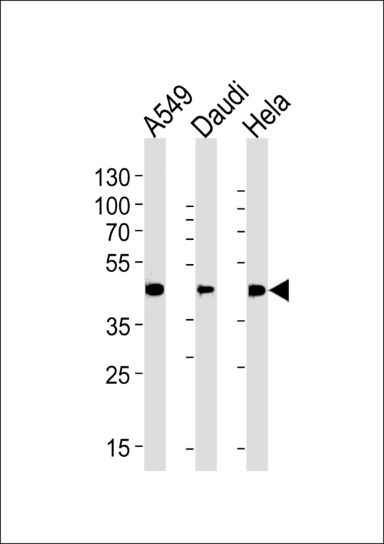 ALDH3A1 Antibody - ALDH3A1 Antibody western blot of A549,Daudi,HeLa cell line lysates (35 ug/lane). The ALDH3A1 antibody detected the ALDH3A1 protein (arrow).