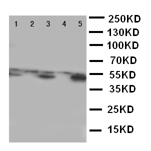 ALDH3A1 Antibody - WB of ALDH3A1 antibody. Lane 1: SMMC Cell Lysate. Lane 2: HELA Cell Lysate. Lane 3: COLO320 Cell Lysate. Lane 4: MCF-7 Cell Lysate. Lane 5: A549 Cell Lysate.